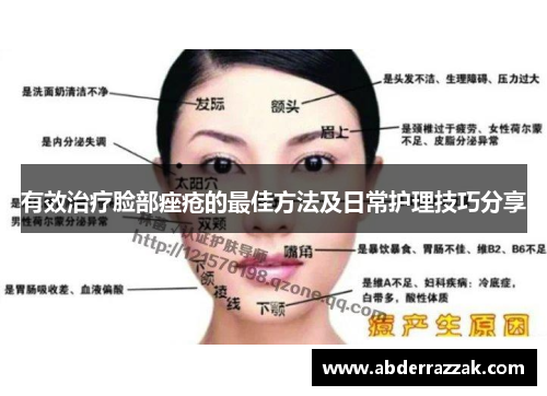 有效治疗脸部痤疮的最佳方法及日常护理技巧分享